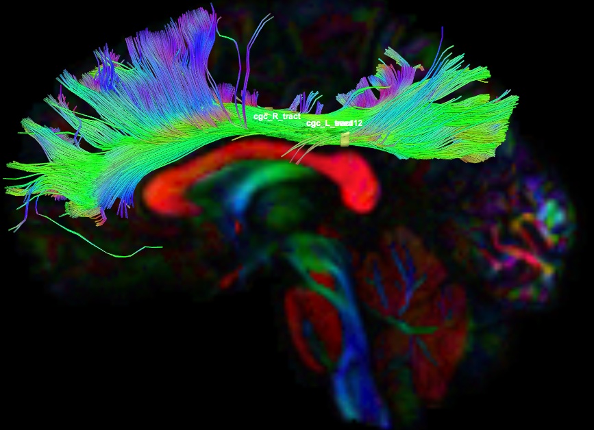 В Чебоксарах наладили производство уникальных мостов для КАМАЗов